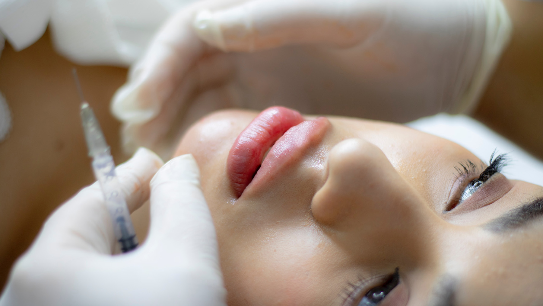 Leistungen aesthetik Faltenbehandlung mit Hyaluronsäure